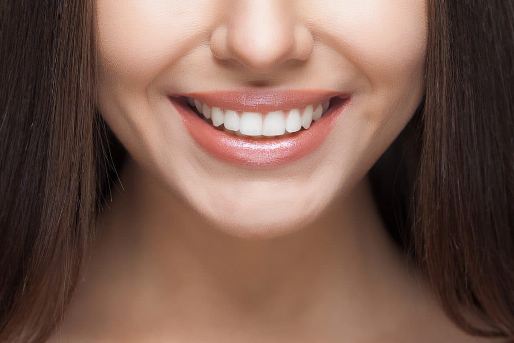 How Much Does Teeth Whitening Cost in Albuquerque, NM?