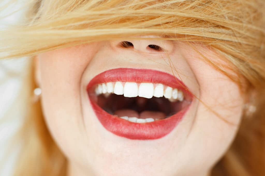 Teeth Whitening at Home vs Teeth Whitening in Dentist Office