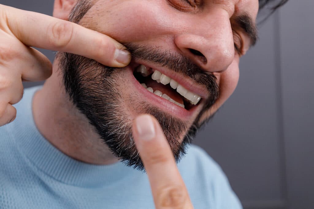 What Happens If You Don’t Replace a Missing Tooth with a Bridge?